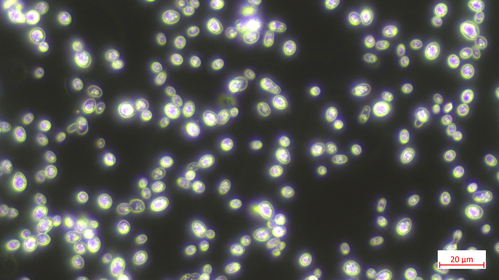 die Hefezellen des Stammes Cella TUM 594 im mikroskopischen Bild 